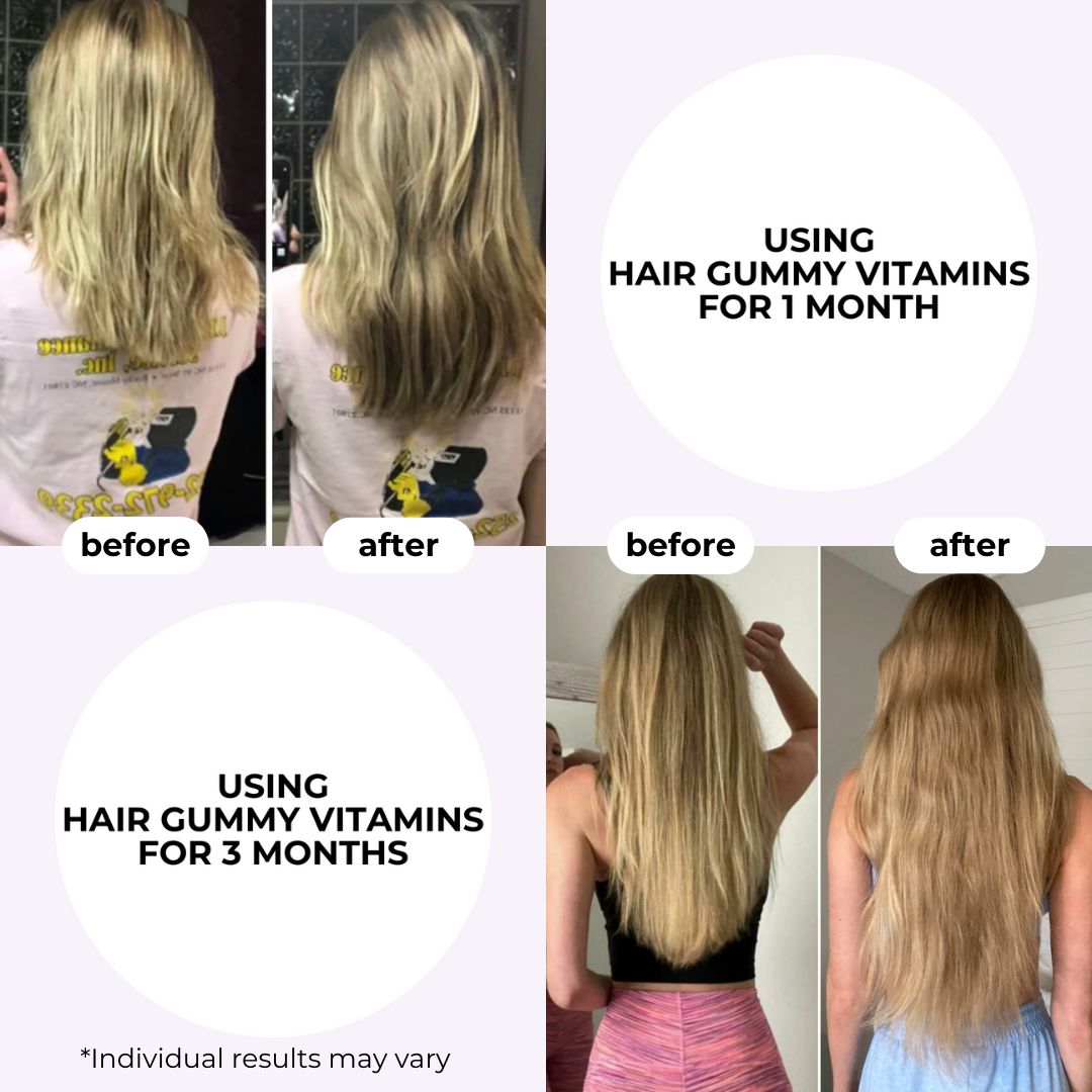 Hair Growth Gummies